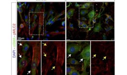 研究发现血管老化和神经变性的新生物标志物